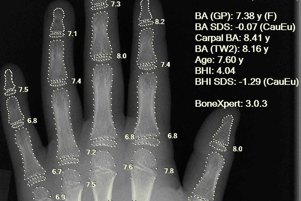 Image of an x-ray of a hand using AI