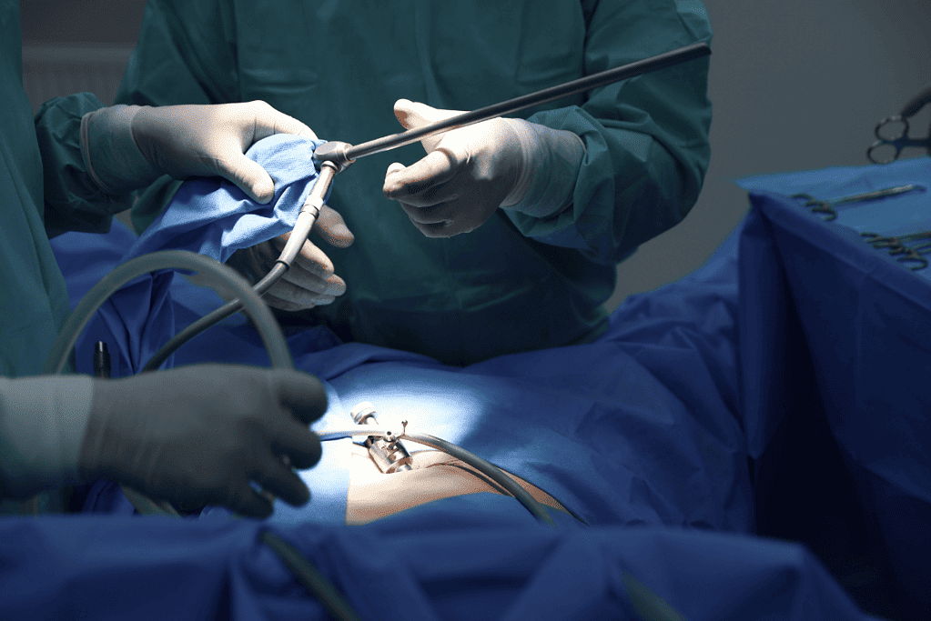 Image of a laparoscopic surgical procedure in progress