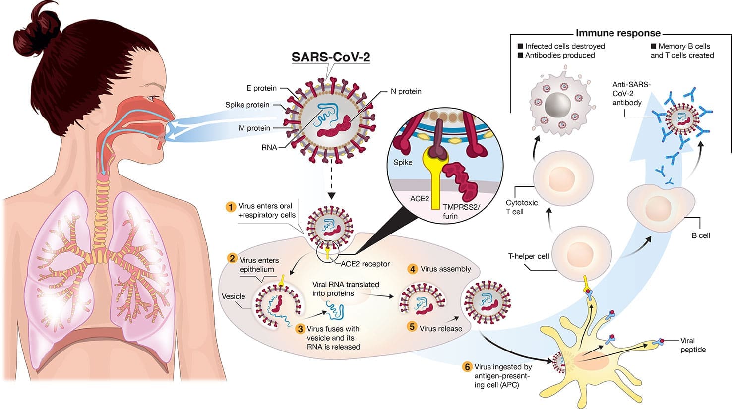 Image of a diagram showing how SARS-CoV-2 infects cells and triggers the body's immune response